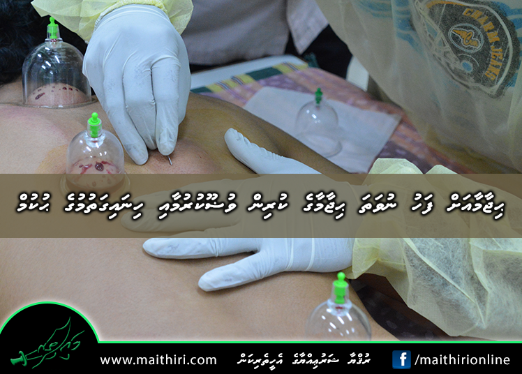 ޙިޖާމާއަށް ފަހު ނުވަތަ ޙިޖާމާގެ ކުރިން ވުޟޫކުރުމާއި ހިނައިގަތުމުގެ ޙުކުމް