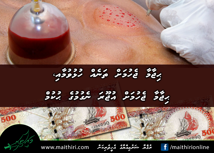 ޙިޖާމާ ޖެހުމަށް ތަނެއް ހުޅުވުމާއި ޙިޖާމާ ޖެހުމަށް އުޖޫރަ ނެގުމުގެ ޙުކުމް